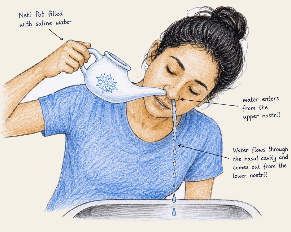 Jala Neti technique: pot tilted into the upper nostril, head sideways, water flowing through the nasal cavity and out of the lower nostril