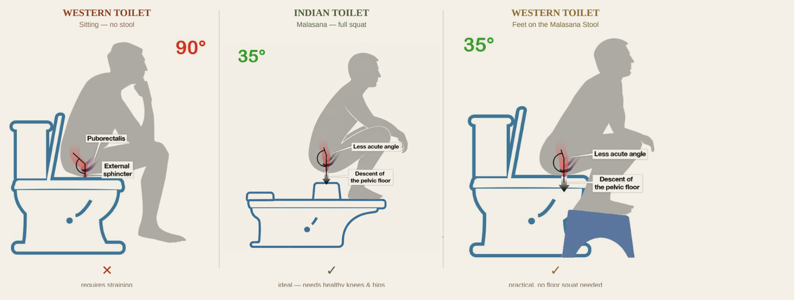 The anorectal angle in three postures: western toilet sitting at 90°, Indian toilet full Malasana squat at 35°, and western toilet with feet on the Malasana Stool at 35°